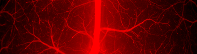 This image from the Zhang Lab illustrates vessels inside the brain that drain blood from a mouse model. Researchers found that these vessels rapidly constrict when movement increases pressure in the body, offering new insight into how the brain and body work together to regulate blood flow. Image courtesy of Qingguang Zhang. 
